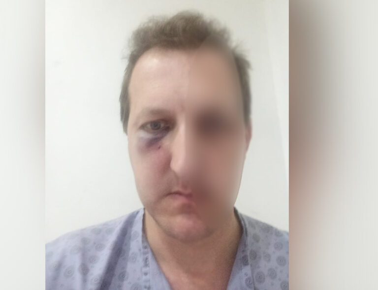 176986460638481854697dfd9eef889